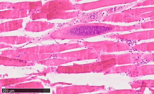 Abbildung 4: - Reh. Histologische Untersuchung der Muskelfleischprobe: Nahansicht Sarkosporidienzyste in der Skelettmuskulatur